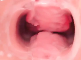 Jap vagina ill-treatment